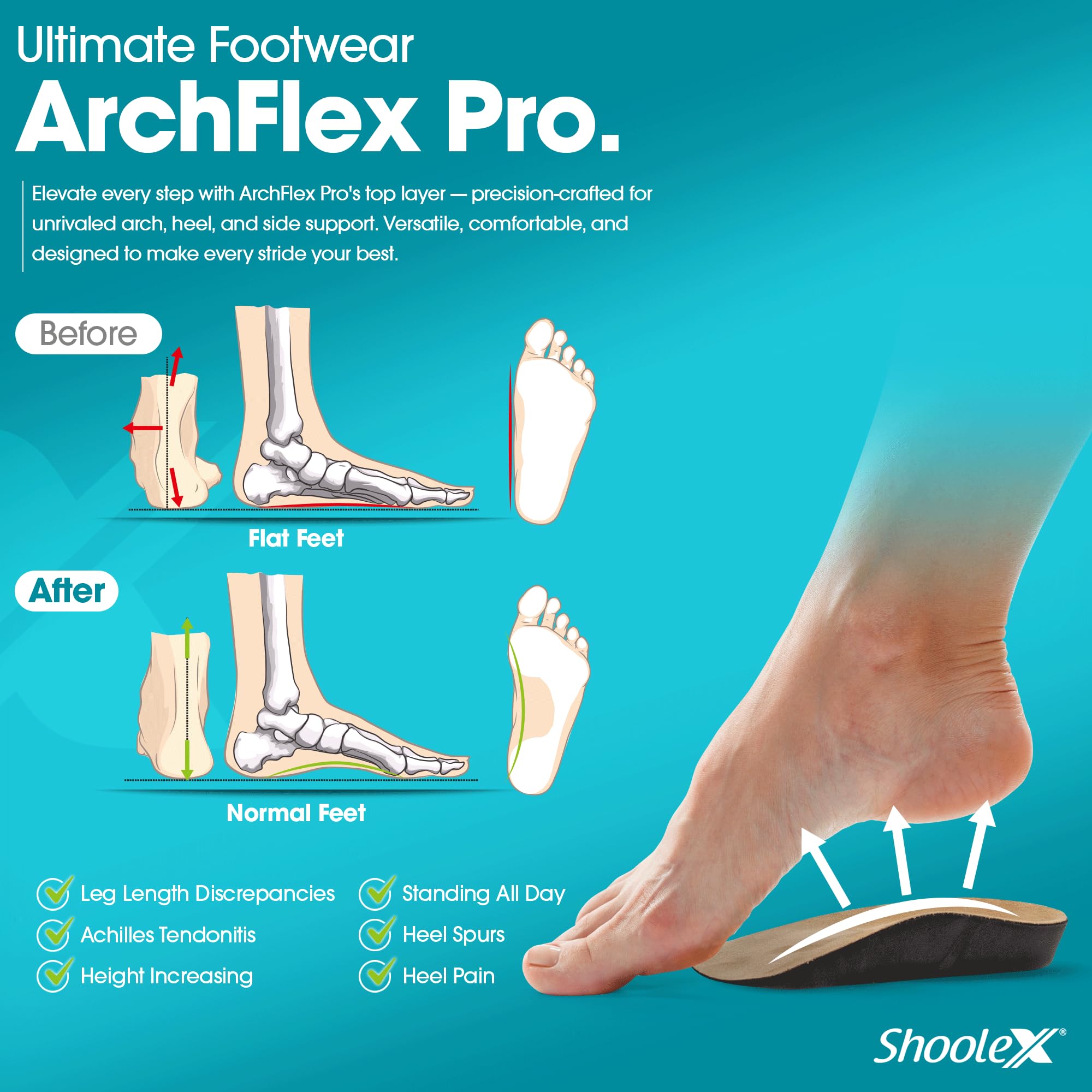 Shoolex 3/4 Adjustable Heel Lifts Insoles for Achilles Tendonitis, Leg Length Discrepancy, Arch Support, Heel Pain, Plantar Fasciitis, Men, Women (Large)